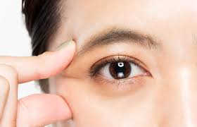 Was sind double eyelid? double eyelid